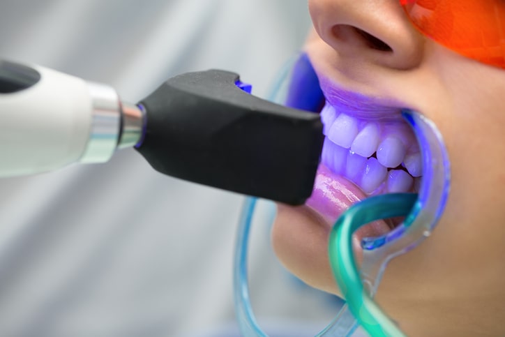 What to Know Before Choosing Long-Term Cosmetic Dental Care in London